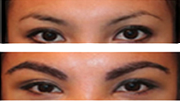 Eyebrows with Thicker Hair without Surgery